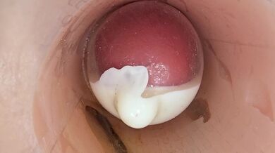 La telecamera nella figa profonda registra un'enorme eiaculazione di sperma nel preservativo