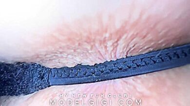 My Ass Will Never Be The Same! Just Look On It Close Up When Im