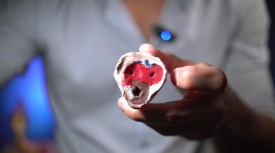 Así se produce una erección – Explicación médica clara